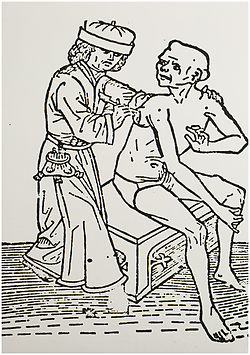 Houtsnede uit de vijftiende eeuw van een chirurgijn die een geval van builen- of bubonenpest behandelt door een gezwel open te snijden. (RHCe, collectie beeld en geluid 117154)